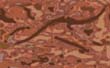 metal_635